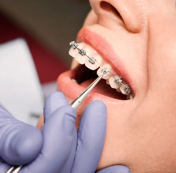 بنر بلاگ ارتودنسی